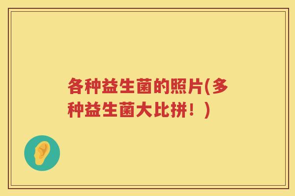 各种益生菌的照片(多种益生菌大比拼!) 各种益生菌的照片(多种益生菌大比拼!)