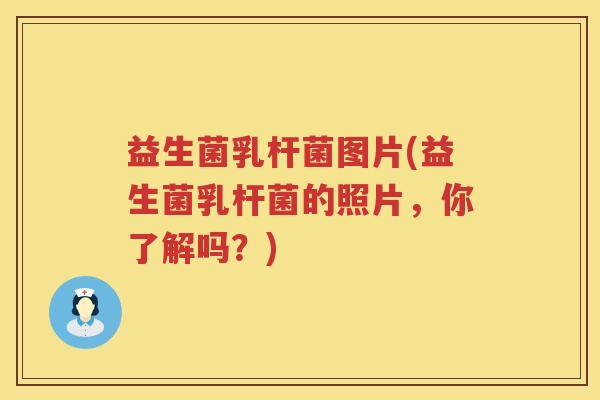 益生菌乳杆菌图片(益生菌乳杆菌的照片,你了解吗?) 益生菌乳杆菌图片(益生菌乳杆菌的照片,你了解吗?)