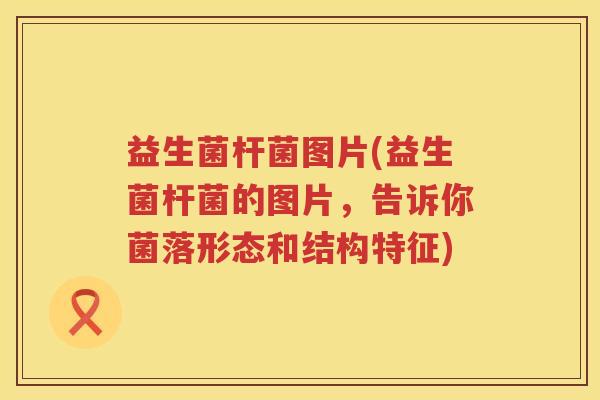 益生菌杆菌图片(益生菌杆菌的图片,告诉你菌落形态和结构特征) 益生菌杆菌图片(益生菌杆菌的图片,告诉你菌落形态和结构特征)