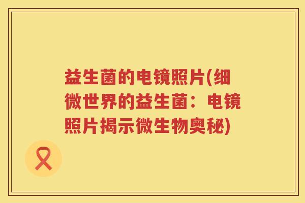 益生菌的电镜照片(细微世界的益生菌:电镜照片揭示微生物奥秘) 益生菌的电镜照片(细微世界的益生菌:电镜照片揭示微生物奥秘)